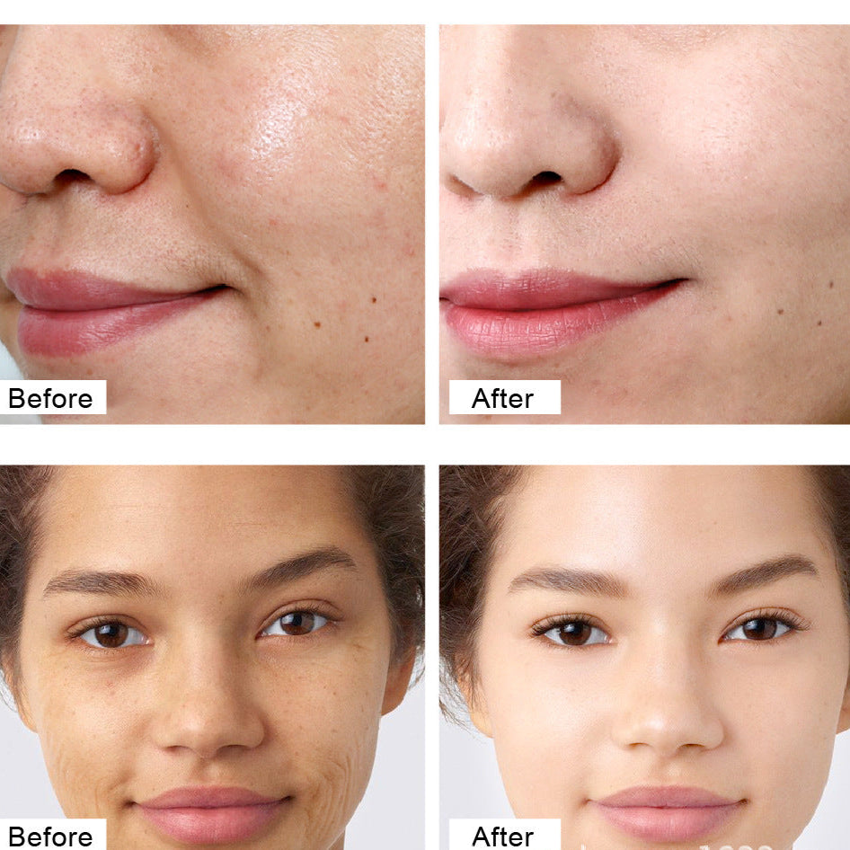Before and after comparison of facial skin treatment on a woman's face.