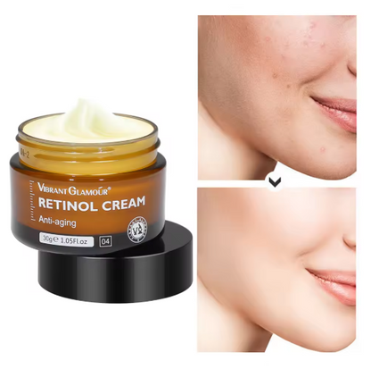 Retinol Facial Cream